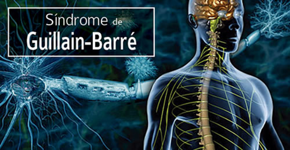 Guillain-Barre Syndrome